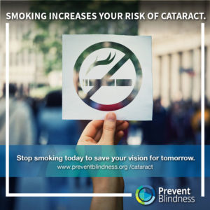 Cataract and Smoking