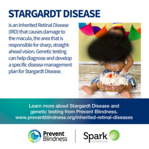 Inherited Retinal Disease - Stargardt Disease