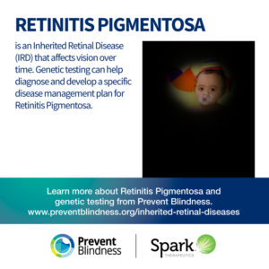 IRD - retinitis pigmentosa