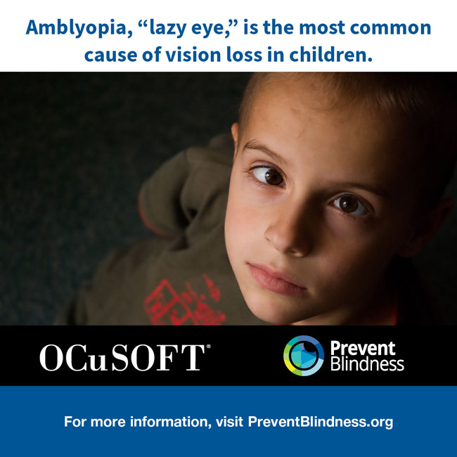 Amblyopia, "lazy eye," is the most common cause of vision loss in children. 