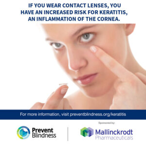 If you wear contact lenses, you have an increased risk for keratitis, an inflammation of the cornea.