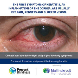 The first symptoms of keratitis, an inflammation of the cornea, are usually eye pain, redness, and blurred vision.
