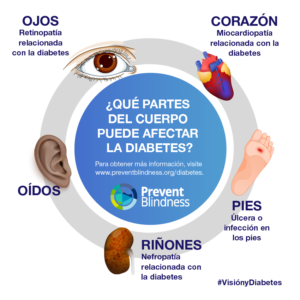 diabetes-related eye disease infographic