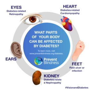 What Parts of Your Body Can Be Affected By Diabetes?